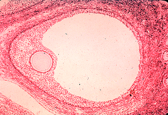 Граафов пузырек (зрелый фолликул)